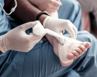 Diabetic Foot Treatment