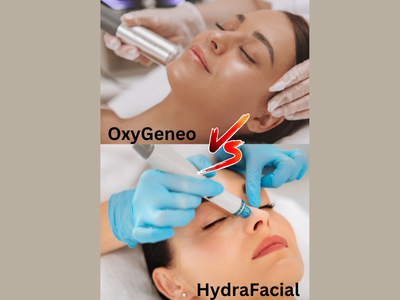 Hydra facial treatment