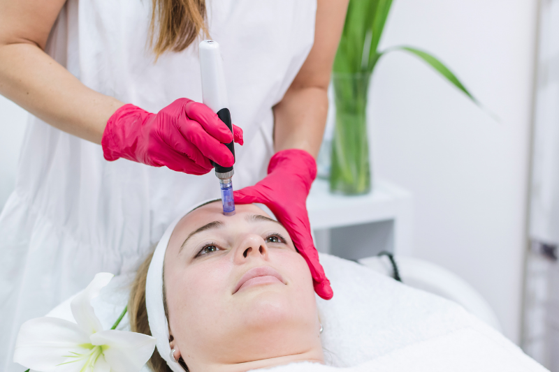 Mesotherapy Treatment