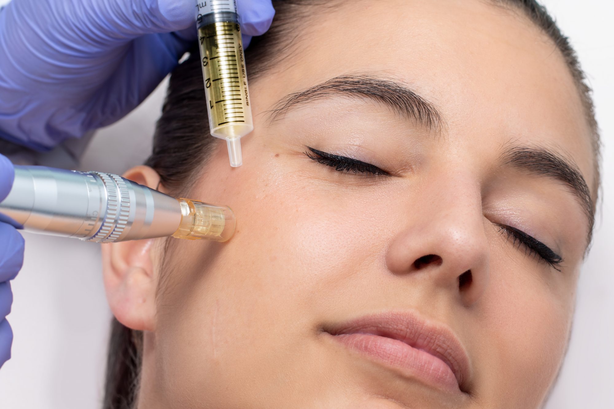 Mesotherapy treatment