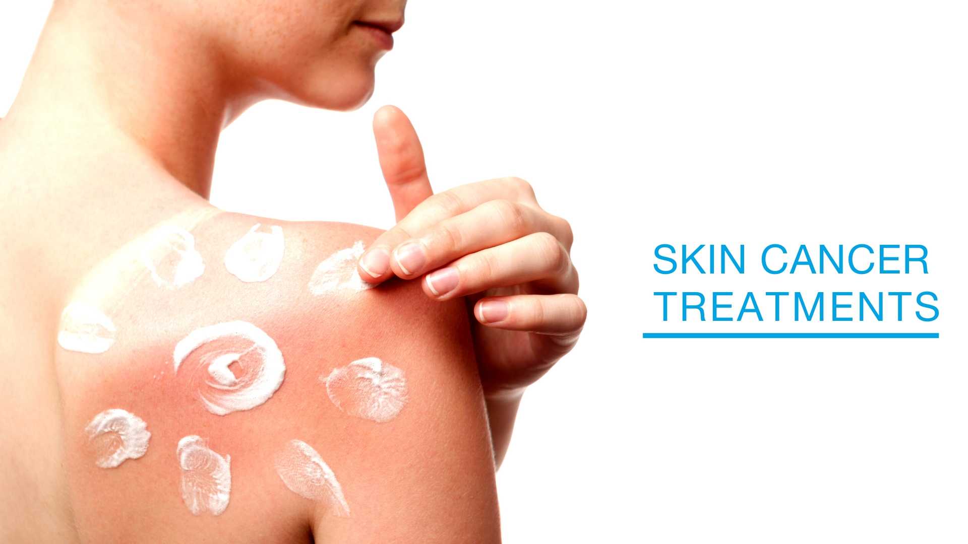 Skin cancer treatments