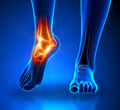 Ankle Specialist In Nagpur
