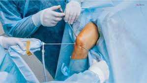 Best Arthroscopy Specialist Doctor In Balaghat