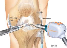 Best Arthroscopy Specialist Doctor In Sagar