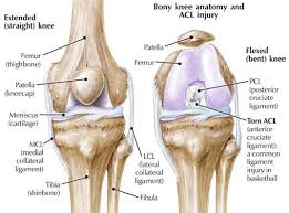 Best Knee Ligament Surgeon In Narsinghpur