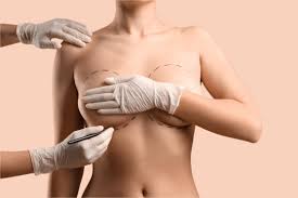 Breast Augmentation In Guna