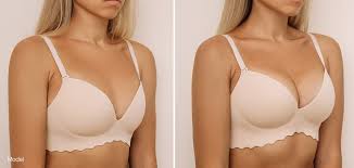 Breast Augmentation in Bhind
