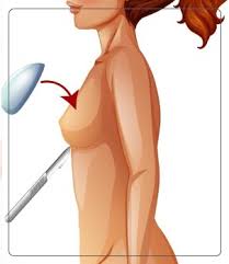 Breast Augmentation in Dhamtari