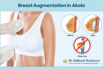 Breast augmentation in akola