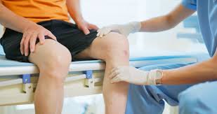 Cartilage Injury Treatment In Nagpur