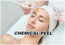 Chemical Peel Treatment in Nagpur