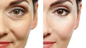 Cosmetic Enhancement in Nagpur