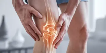 Early stage knee arthritis