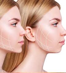 Fat Removal Surgery in Nagpur