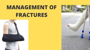 Fracture stabilization