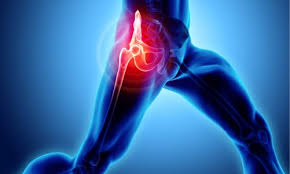 Hip Replacement Surgery in Mohla‑Manpur‑Ambagarh Chowki