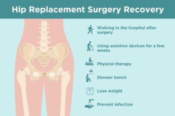Hip replacement surgery in akola