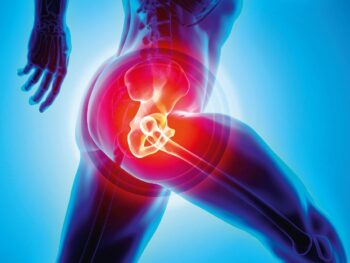 Hip replacement surgery in amravati