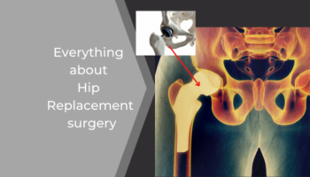 Hip replacement surgery in gondia