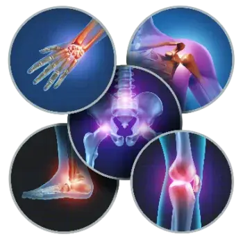 Improved joint function relief (ssh)