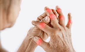 Joint Pain Treatment In Mandsaur