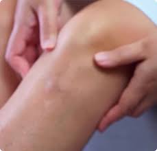 Joint Pain Treatment in Mungeli