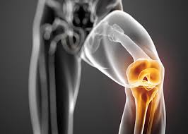Knee Replacement Surgery in Manendragarh-Chirmiri-Bharatpur