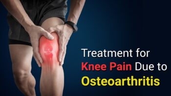 Knee osteoarthritis treatment