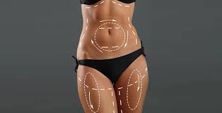 Liposuction In Burhanpur