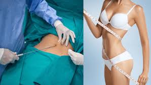 Liposuction In Seoni
