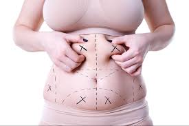 Liposuction In Ujjain