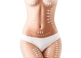 Liposuction in Balod