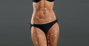 Liposuction in Bemetara