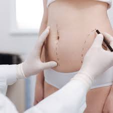 Liposuction in Gariaband