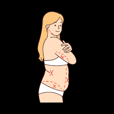 Liposuction in Kondagaon