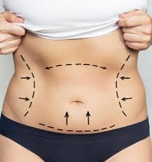 Liposuction in Mahasamund