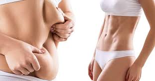 Liposuction in Nagpur