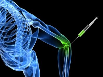 Next gen joint replacement