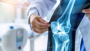 Orthopedic Surgeon in Bemetara