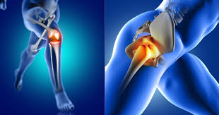 Orthopedic Surgeon in Bilaspur