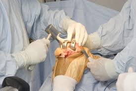 Orthopedic Surgeon in Dhamtari