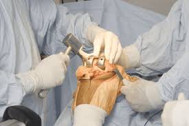 Orthopedic Surgeon in Khairagarh-Chhuikhadan-Gandai