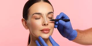 Rhinoplasty in Guna