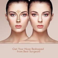 Rhinoplasty in Mahasamund