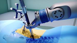 Robotic Assisted Surgery In Guna