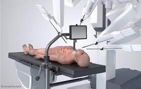 Robotic Assisted Surgery in Korba