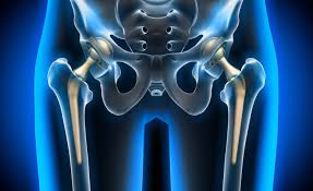 Robotic Hip Replacement In Chhatarpur