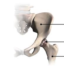Robotic Hip Replacement in Korba