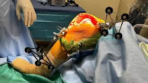 Robotic Knee Replacement In Bhind