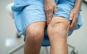 Robotic Knee Replacement In Singrauli